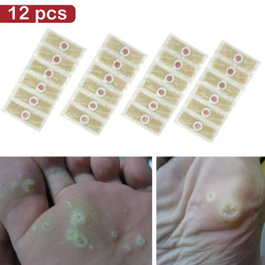 Ointment MO COCHON Warts Horns feet 10G in pharmacy